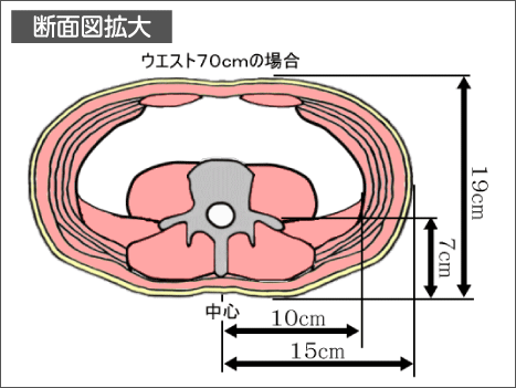 腰痛は腰痛アカデミーで、ヘルニア、狭窄症も治る、更に坐骨神経痛も治す坂戸孝志の名医による腰痛は自分で治せる克服法