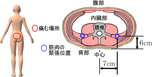 腰痛を治す腰痛アカデミーは腰痛やヘルニア、狭窄症、坐骨神経痛を克服するため坂戸孝志先生により考案された自分で治せる克服法