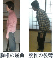腰痛を腰痛アカデミーで克服させ、ヘルニア、狭窄症、坐骨神経痛等の痛みを改善させるための名医坂戸孝志のサポートを受けられた胸椎の屈折・腰椎の後攣。